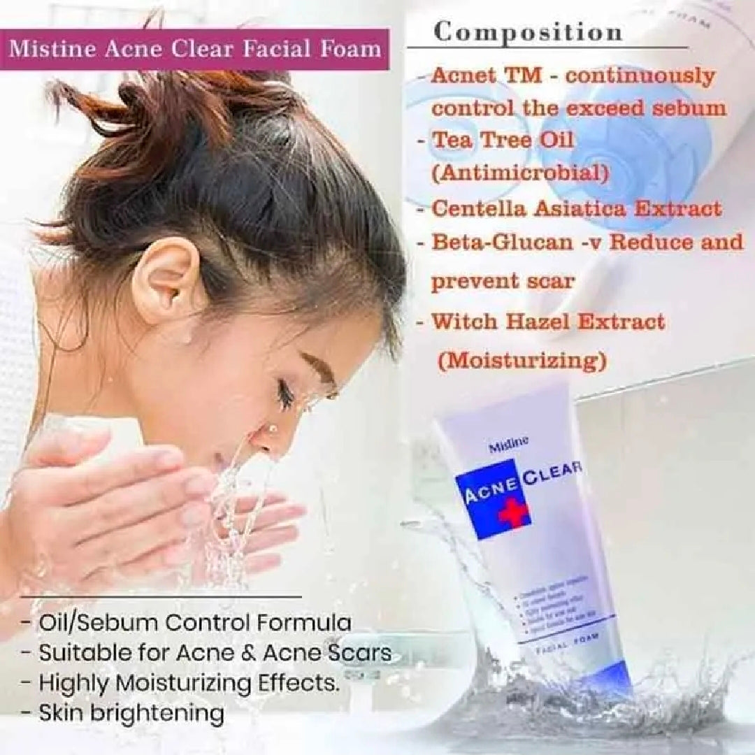 Mistine Acne Clear Facial Foam (85g) - Oil Control & Acne Care Face Wash