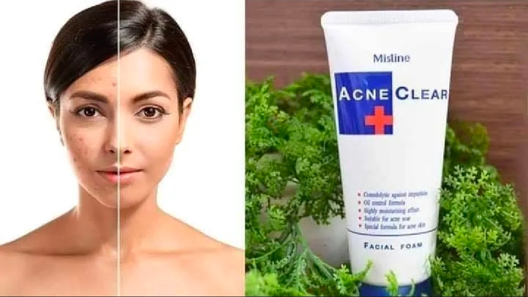 Mistine Acne Clear Facial Foam (85g) - Oil Control & Acne Care Face Wash